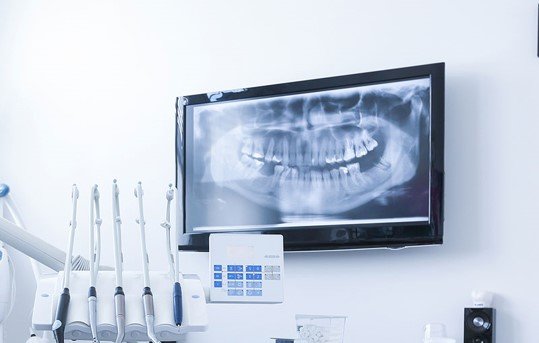 Digital X-rays