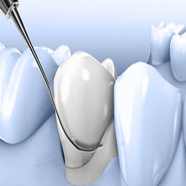 Periodontology